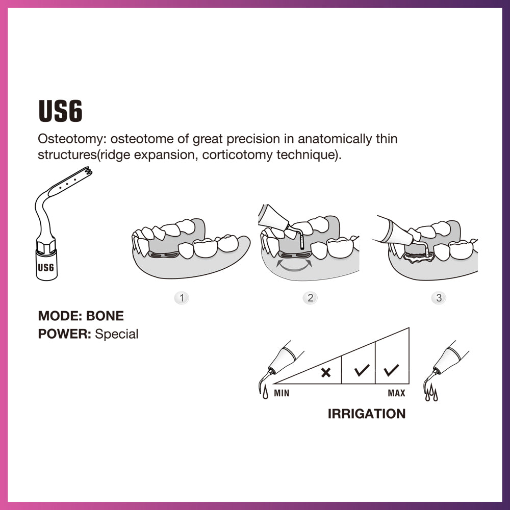 Woodpecker / Mectron Ultra Surgery Tip - US6