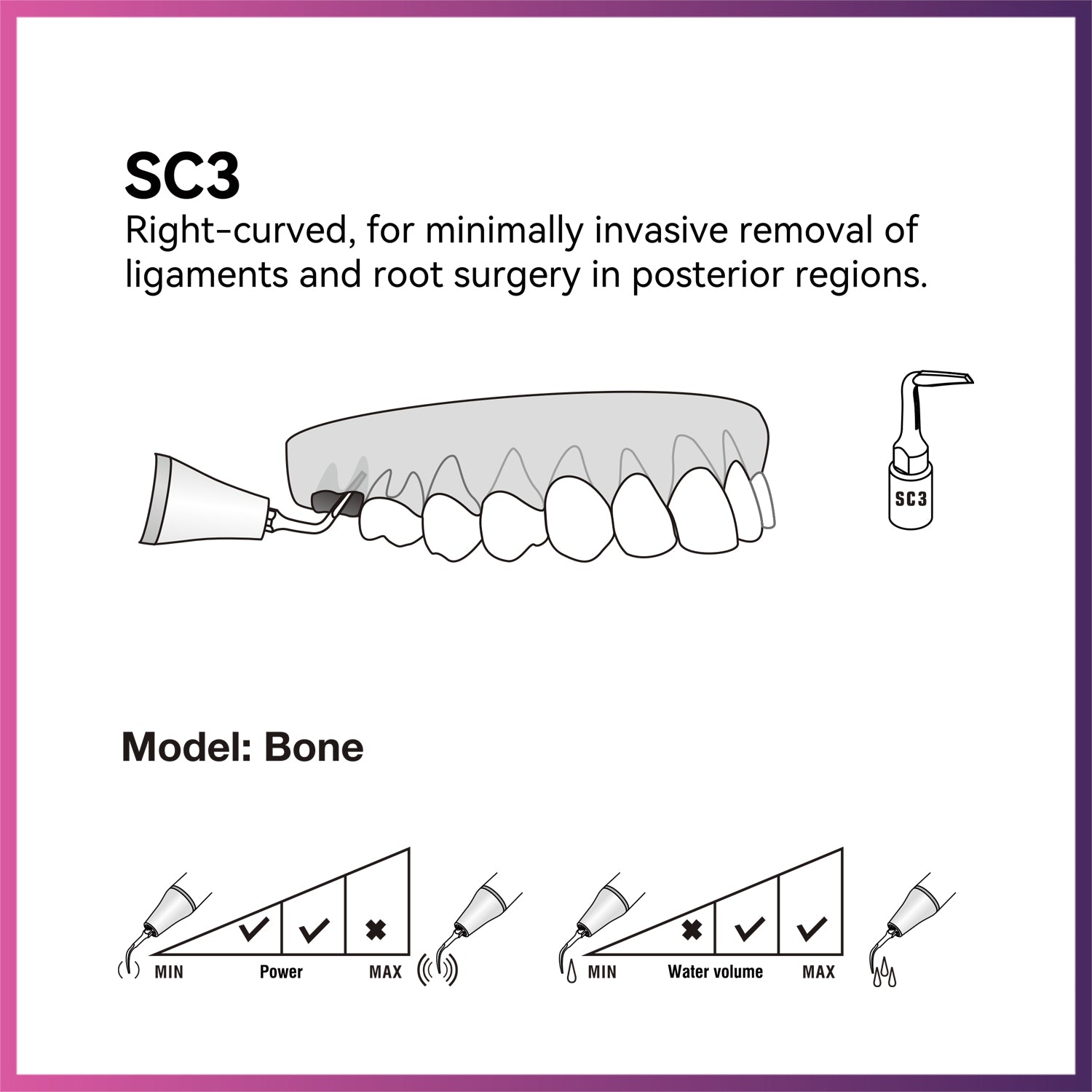 Woodpecker / DTE Surgery Tip - SC3