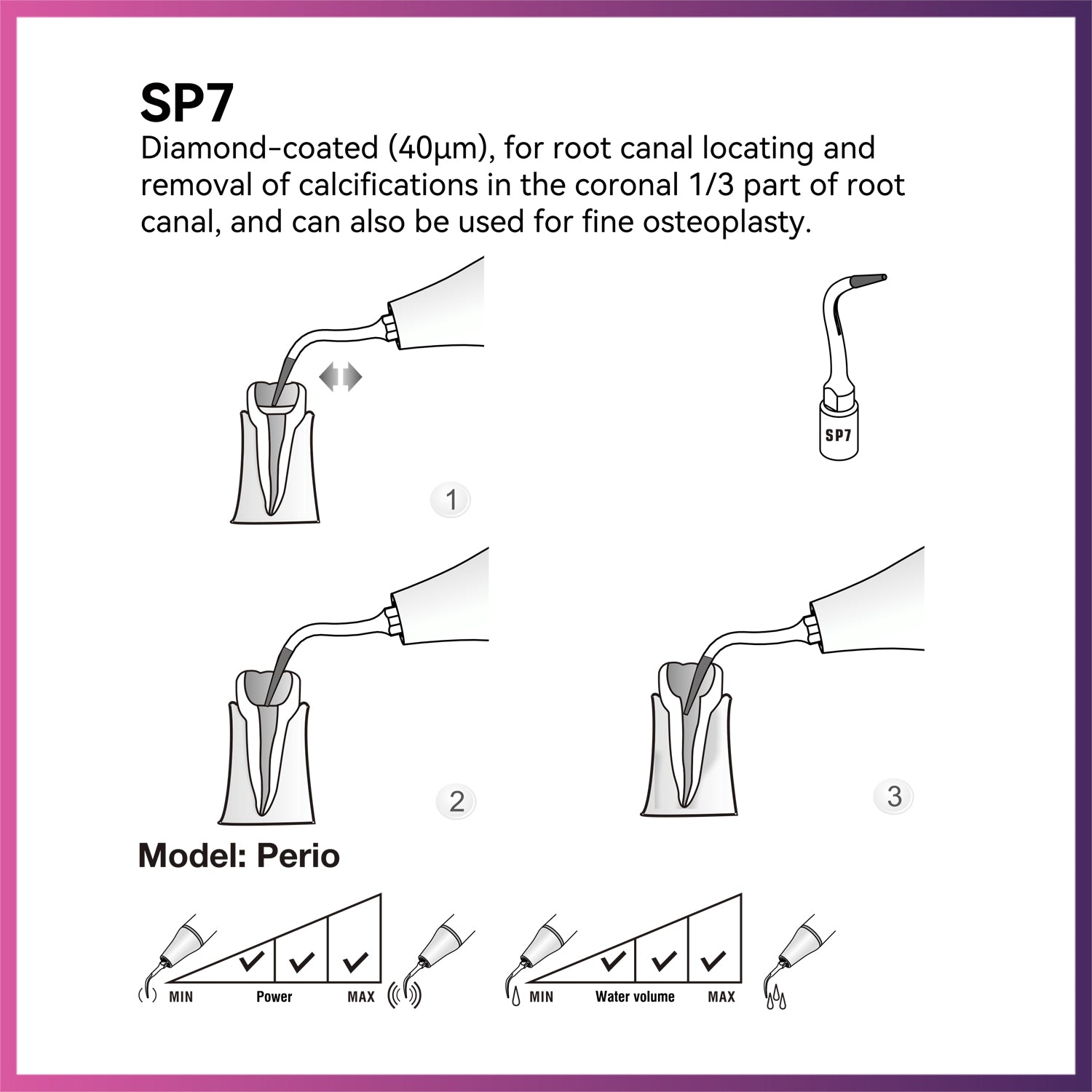 Woodpecker / DTE Surgery Tip - SP7