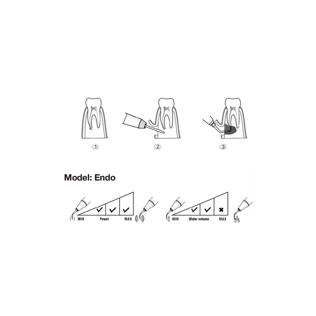 Woodpecker / DTE  Surgery Tip - SE7