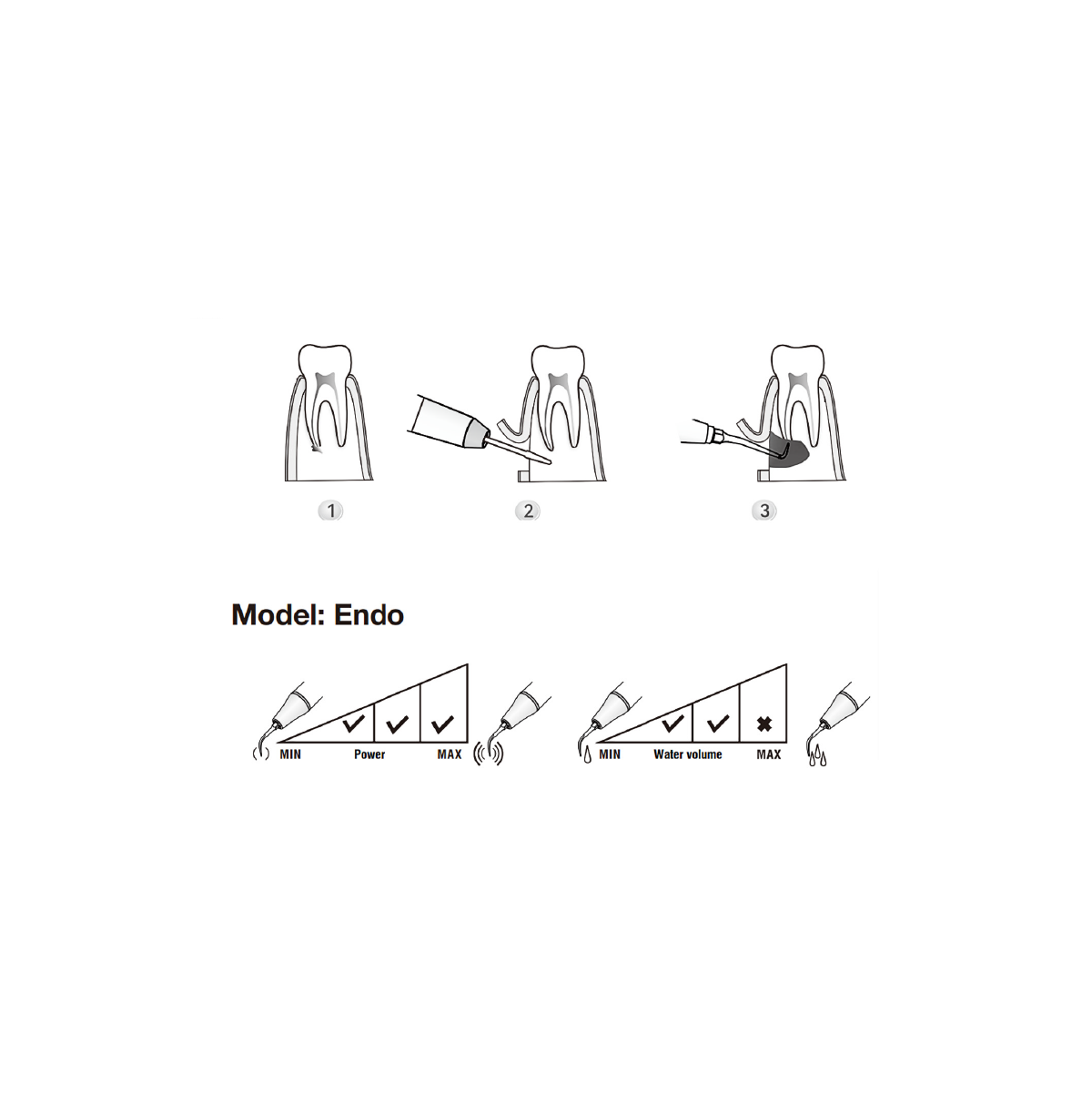 Woodpeckers / DTE Surgery Tip - SE8