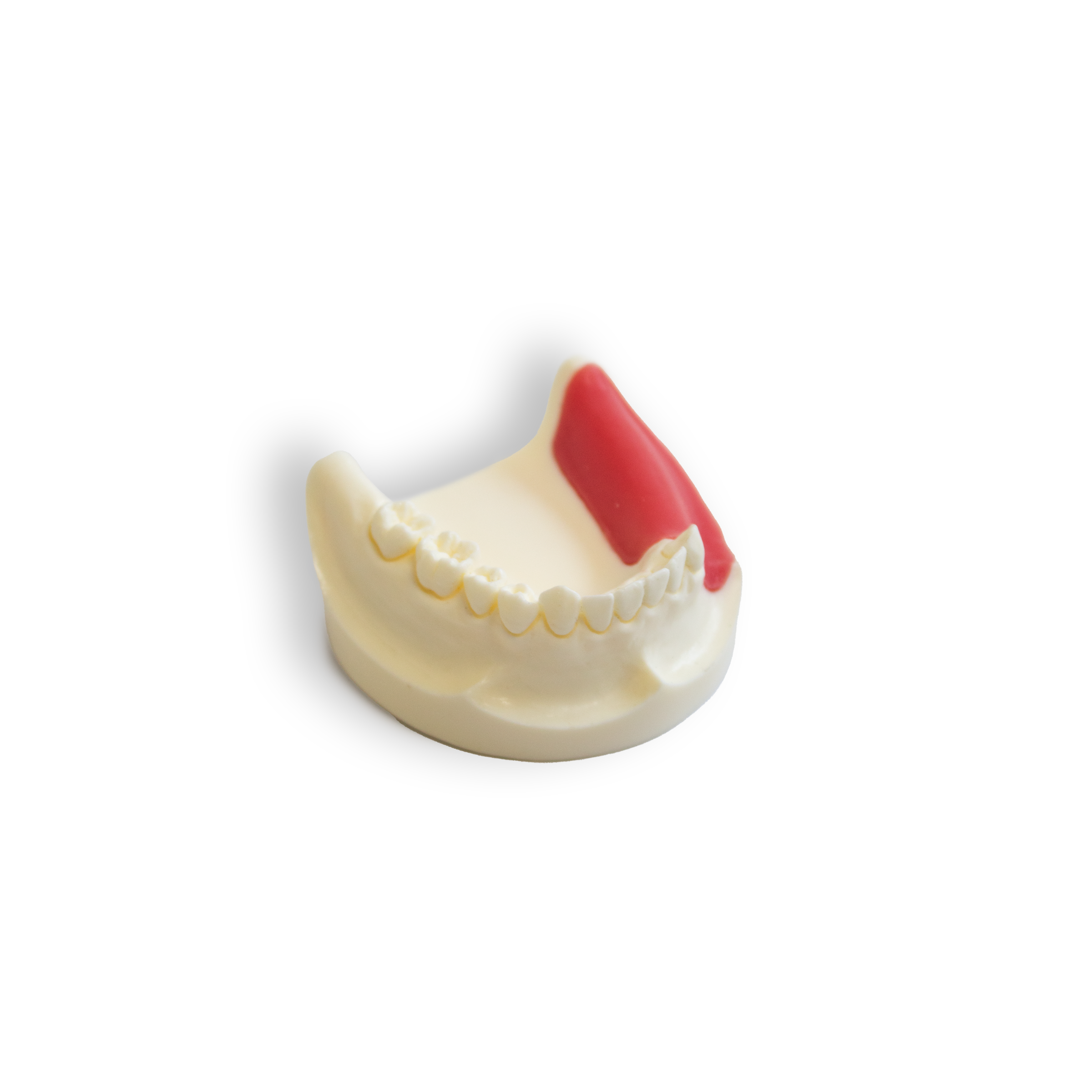 Implant Model (Lower & Upper Jaw)