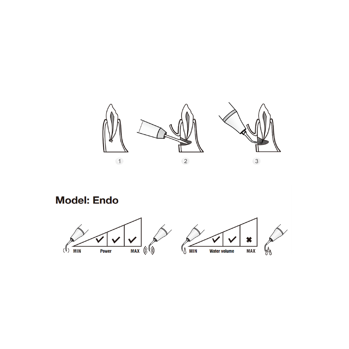 Conseils de chirurgie Woodpecker / DTE SE2