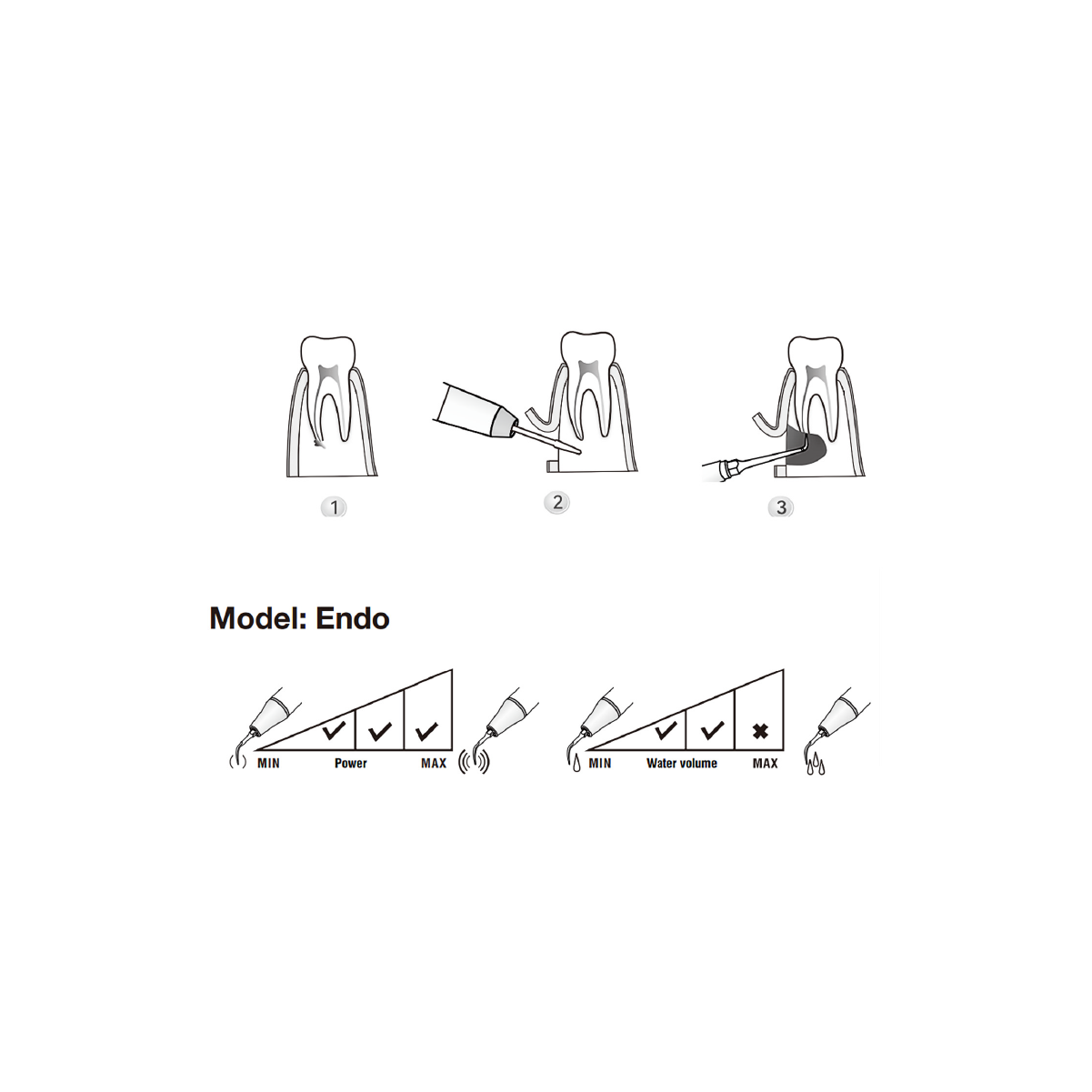 Woodpecker / DTE  Surgery Tip - SE5