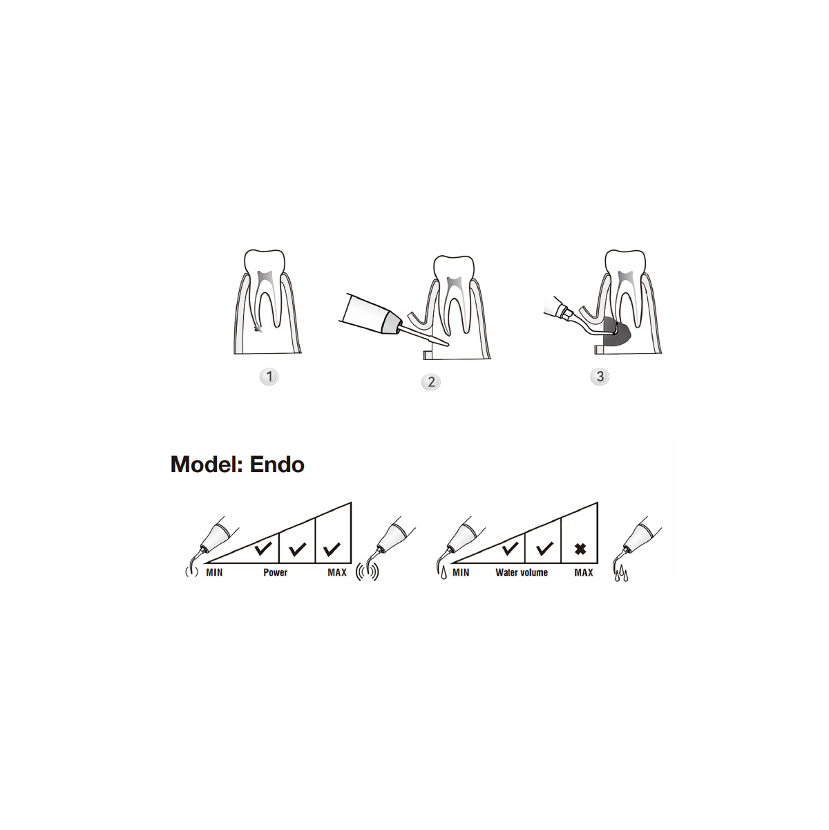 Woodpecker / DTE  Surgery Tip - SE6