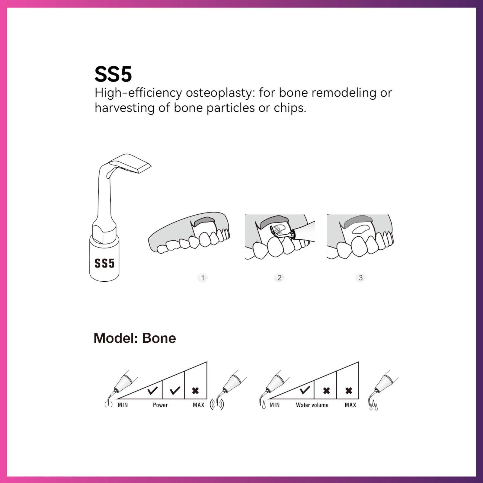 Woodpecker / DTE Surgery Tip - SS5