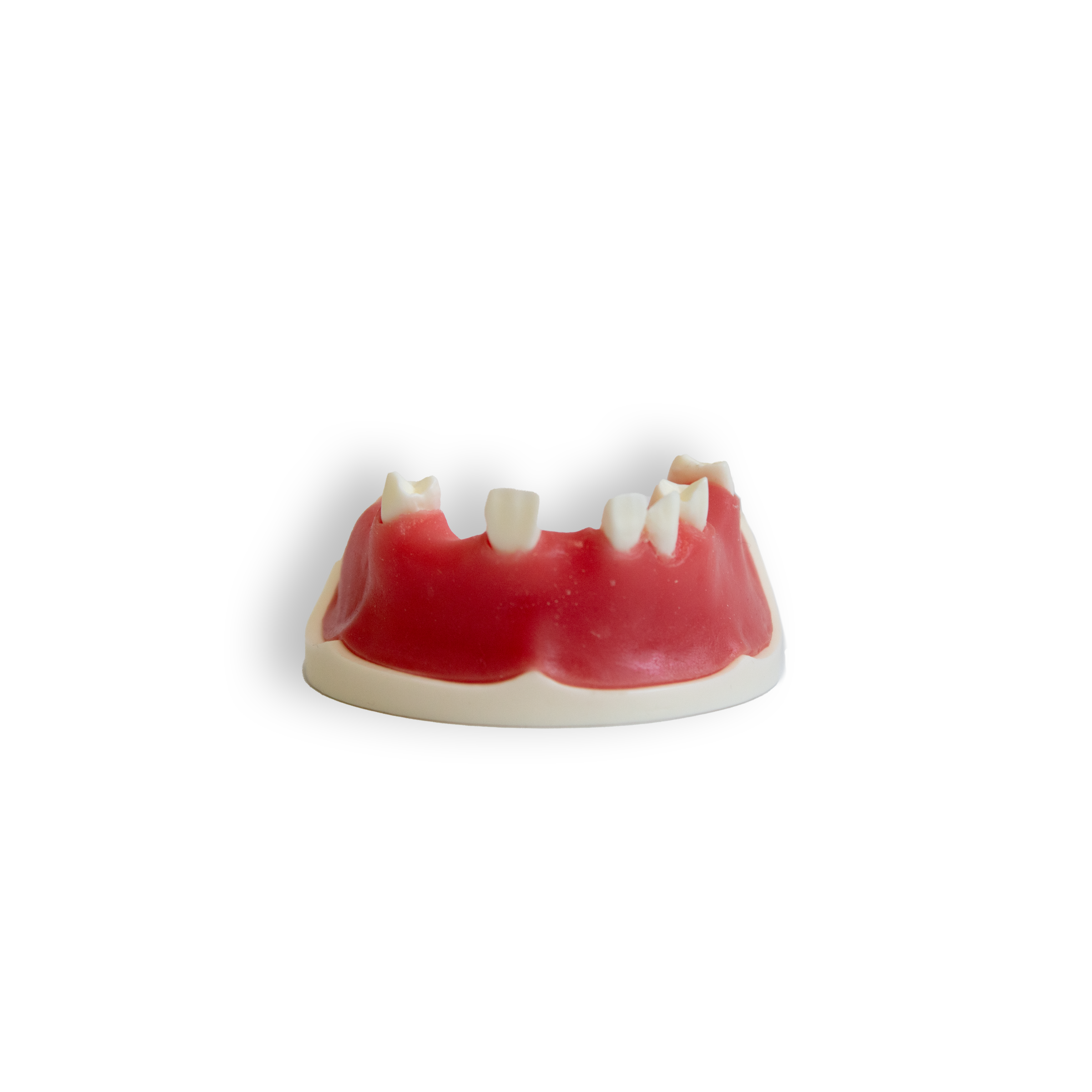 Implant Model (Lower & Upper Jaw)