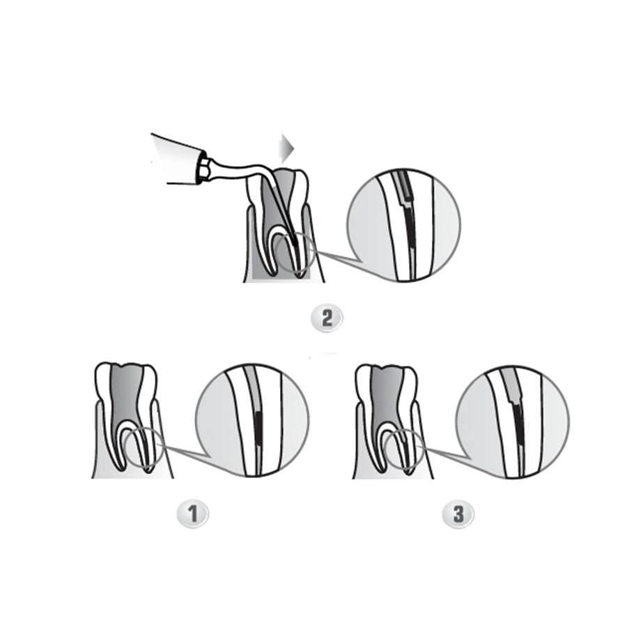 Punta para raspador ultrasónico - ED3D