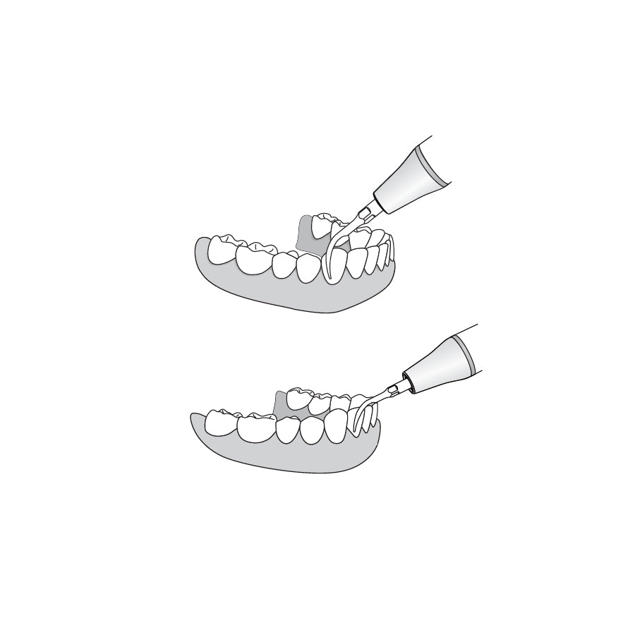 Punta para raspador ultrasónico Woodpecker/DTE - G1 (paquete de 5) 