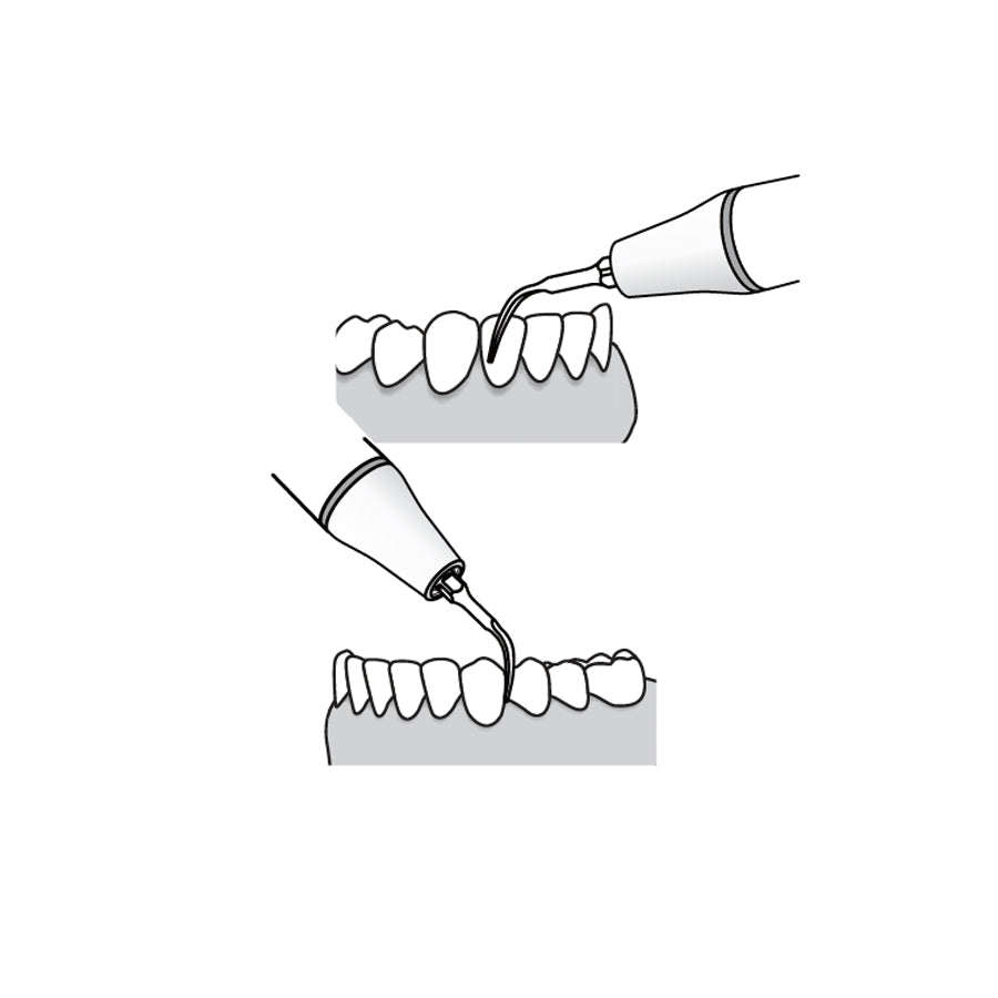 Woodpecker / Ultrasonic Scaler Tip- G4 (pack of 5)