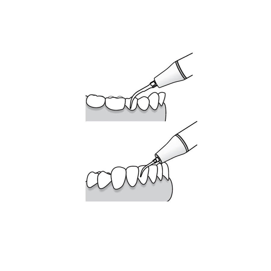 Woodpecker / Ultrasonic Scaler Tip - G5 (pack of 5)